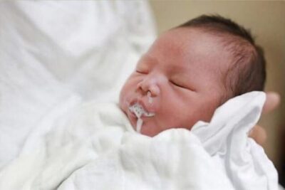 SẶC SỮA Ở TRẺ NHỎ – MỐI NGUY CƠ ĐE DỌA TÍNH MẠNG NGAY TRONG VÒNG TAY CHA MẸ.